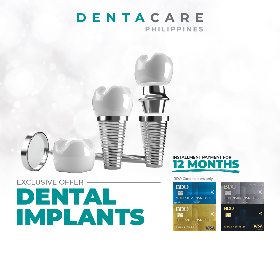 Dental Implants Installment Promo