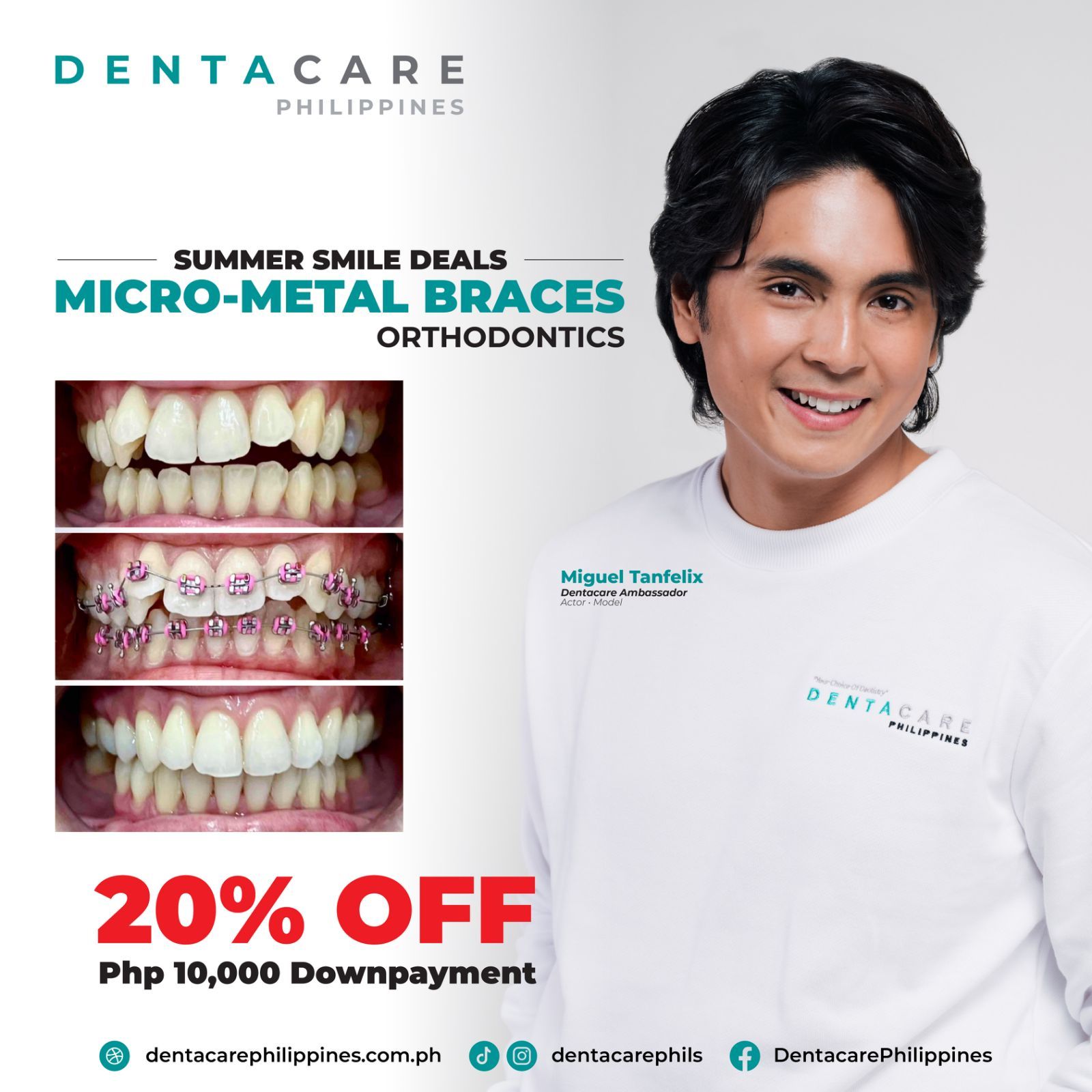 Braces Myths Filipinos Still Believe (And the Truth Behind Them)